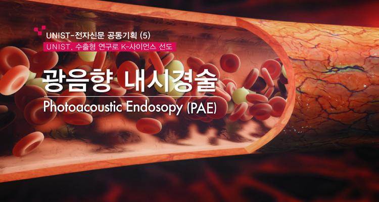 [UNIST, 수출형 연구로 K-사이언스 선도] (5) 차세대 의료영상 기술, 광음향 내시경