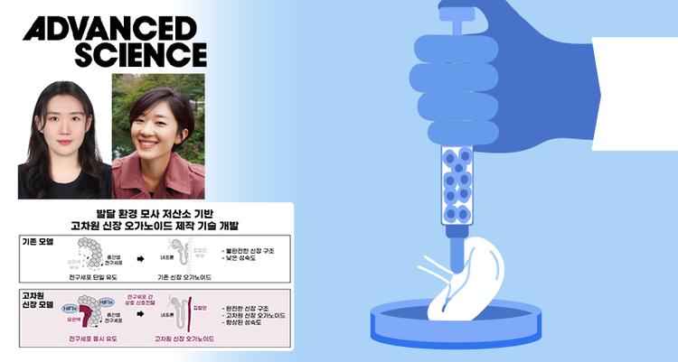 더 진짜 같은 인공 미니 신장 나왔다!